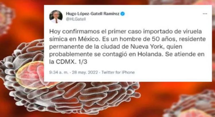 Confirman primer caso de viruela de mono en México