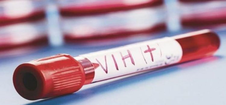 En Sudáfrica realizarán primer ensayo clínico de vacuna contra VIH