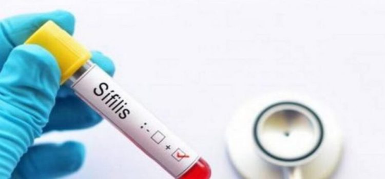 Aumentan casos de sífilis en Jalisco