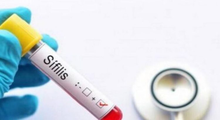 Aumentan casos de sífilis en Jalisco