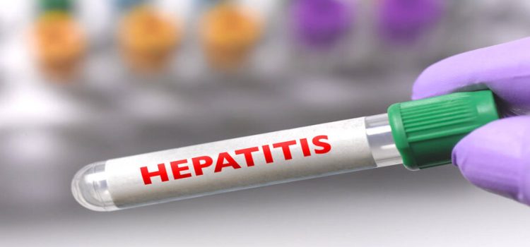 Reportan 2 nuevos casos sospechosos de hepatitis aguda en Jalisco