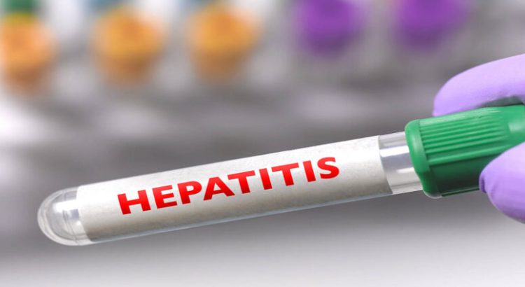Reportan 2 nuevos casos sospechosos de hepatitis aguda en Jalisco