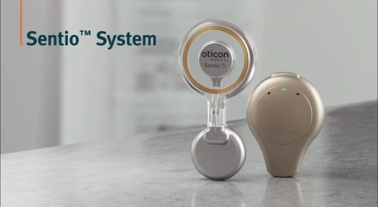 Oticon Medical es reconocido por su Sentio System